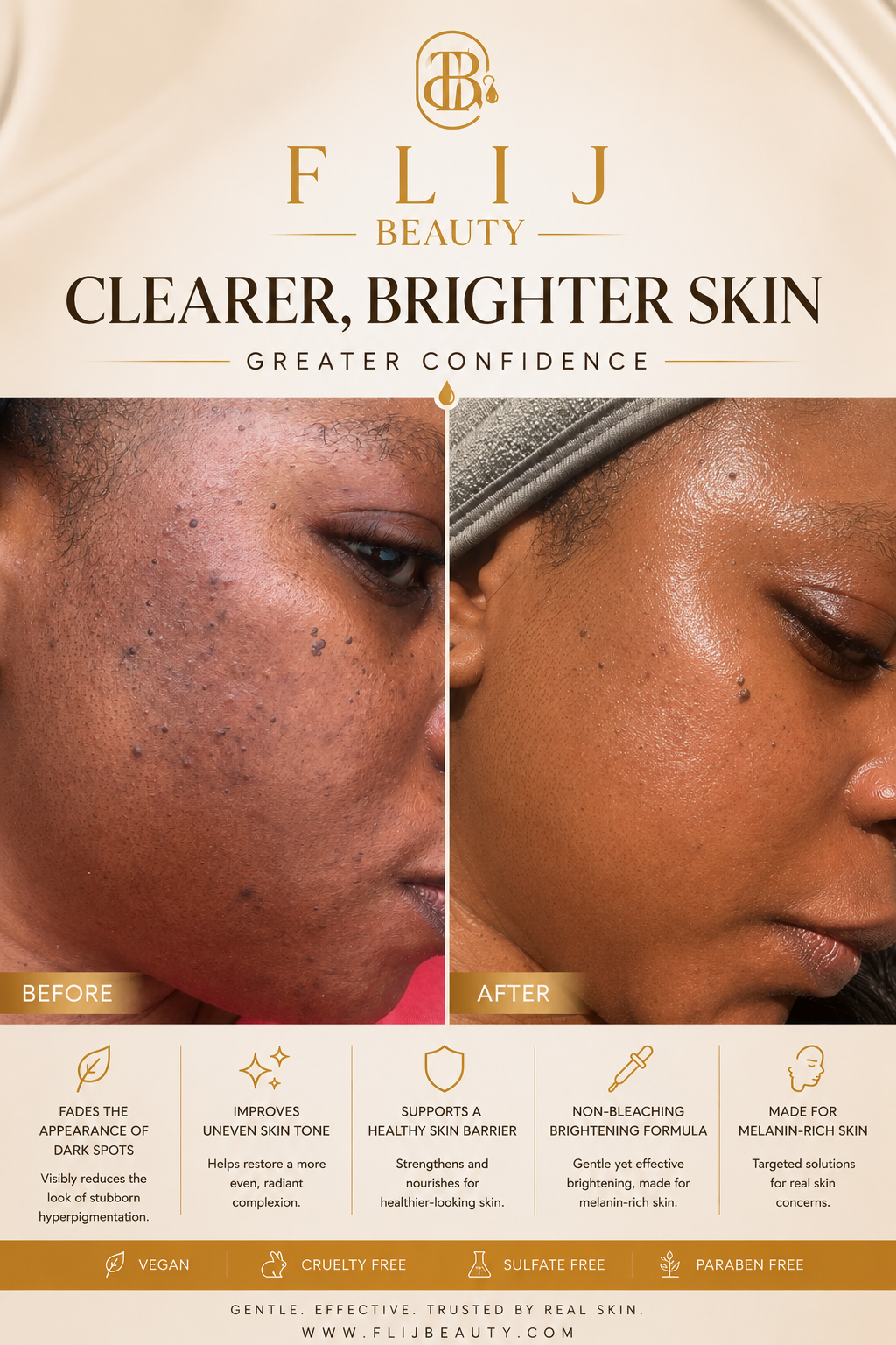 Dark Spot & Hyperpigmentation Face Set (Oily & Acne-prone skin)