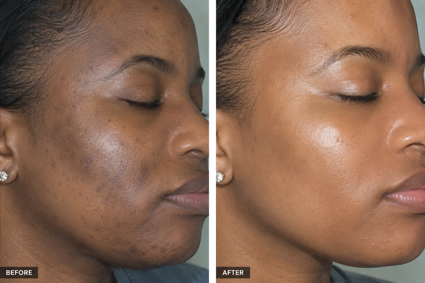 Dark Spot & Hyperpigmentation Face Set (Sensitive & Dry Skin)