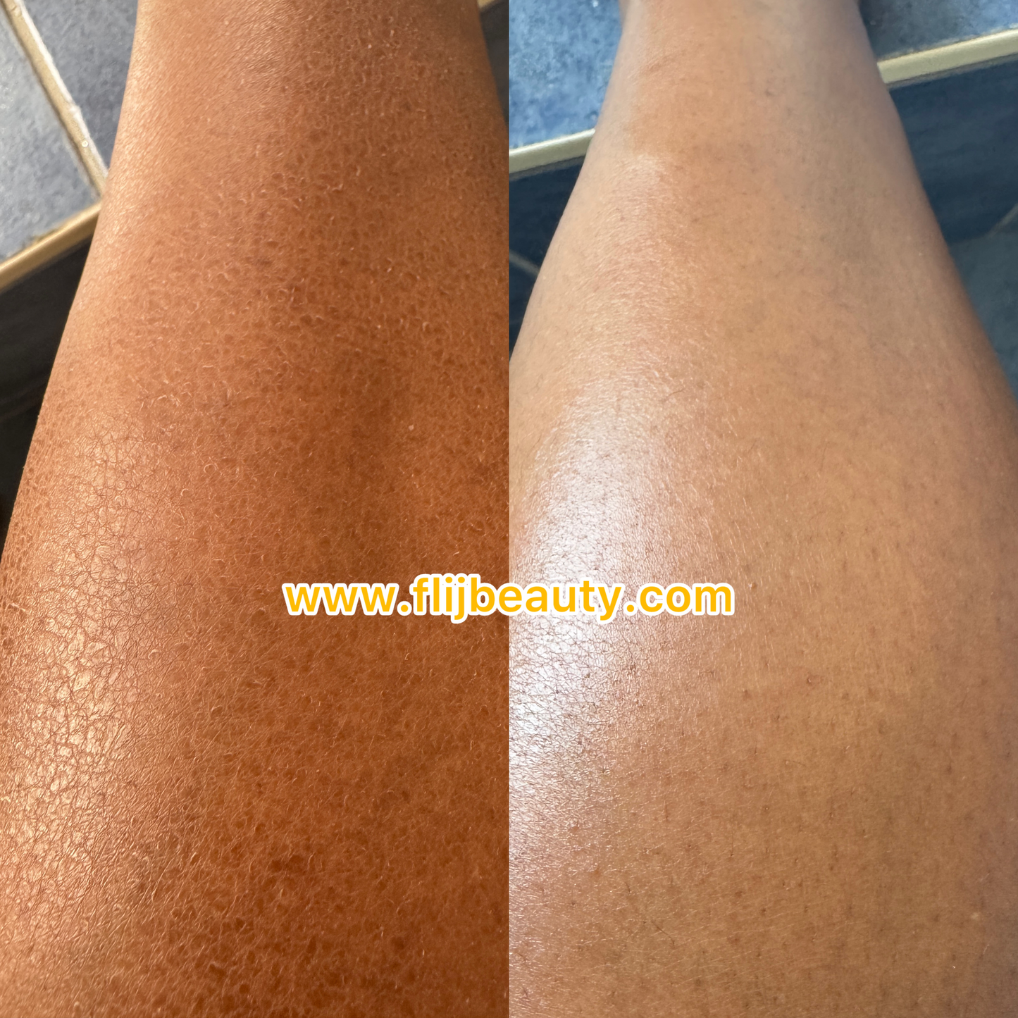 Body Brightening Bundle